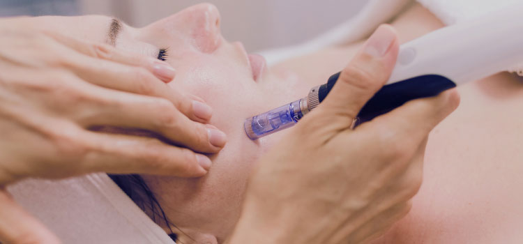 Featured image for “Microneedling vs Chemical Peels – Which Skin Treatment Is Right for You?”